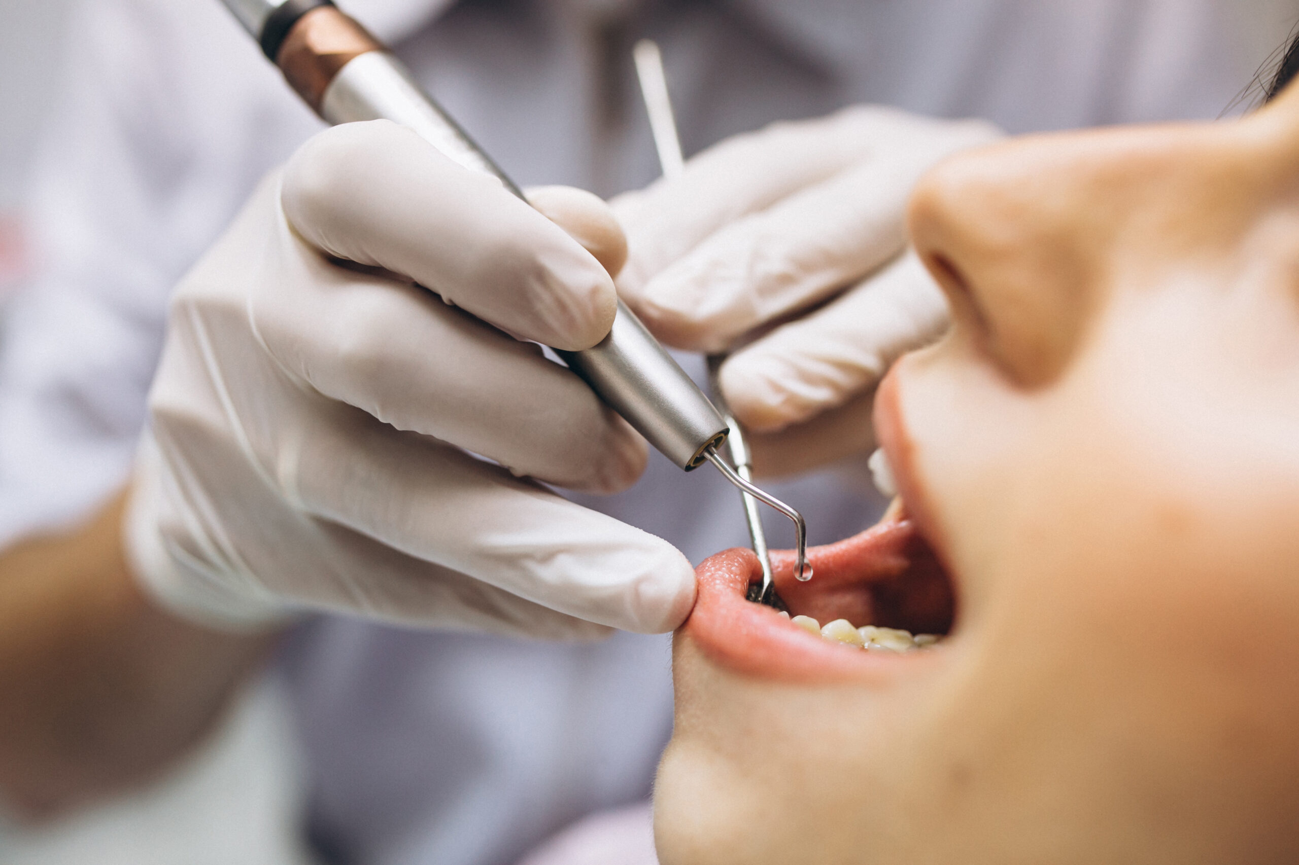 Leia mais sobre o artigo A importância das visitas frequentes ao dentista, os chamados check up